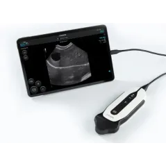 Ecograf ultraportabil pentru uz veterinar Chison SonoEye VET