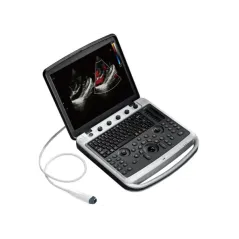 Ecograf pentru uz veterinar Chison SonoBook 8 VET