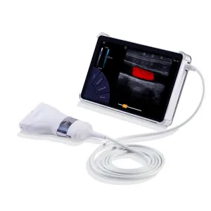 Ecograf ultraportabil - Sonoscanner U-Lite PRO