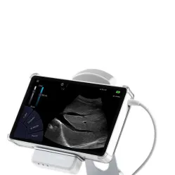 Ecograf ultraportabil - Sonoscanner U-Lite PRO