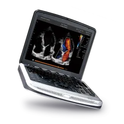 Ecograf CHISON SonoBook 7 cu sonda convexa si liniara inclusa