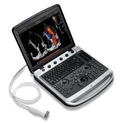 Ecograf CHISON SonoBook 9 cu sonda liniara si sectoriala