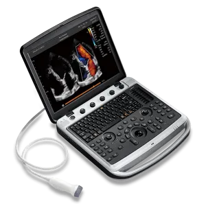 Ecograf CHISON SonoBook 9 cu sonda liniara si sectoriala