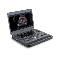 Ecograf portabil Doppler color SonoScape X3