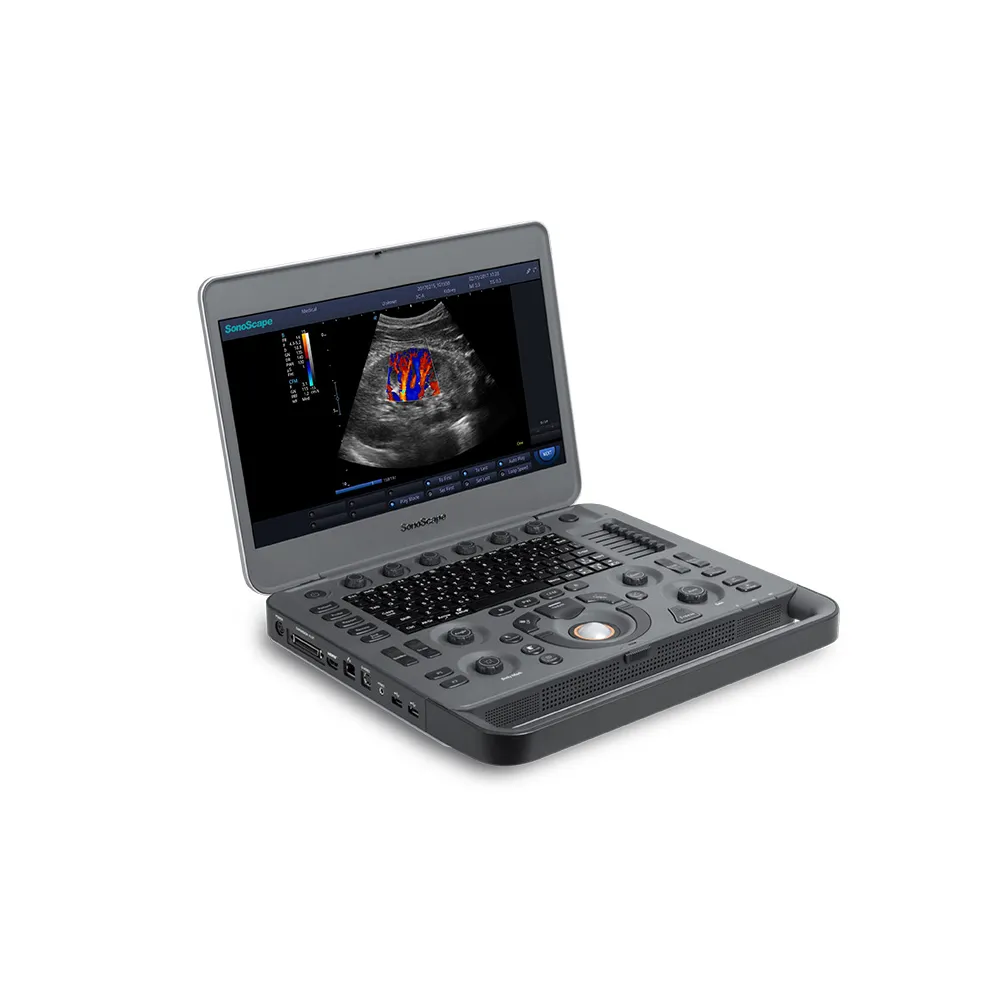 Ecograf portabil Doppler color SonoScape X3