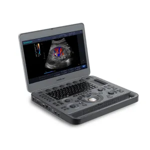 Ecograf portabil Doppler color SonoScape X3