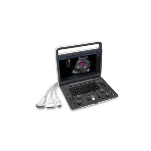 Ecograf portabil Doppler color SonoScape E3