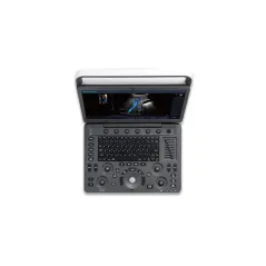 Ecograf portabil Doppler color SonoScape E2