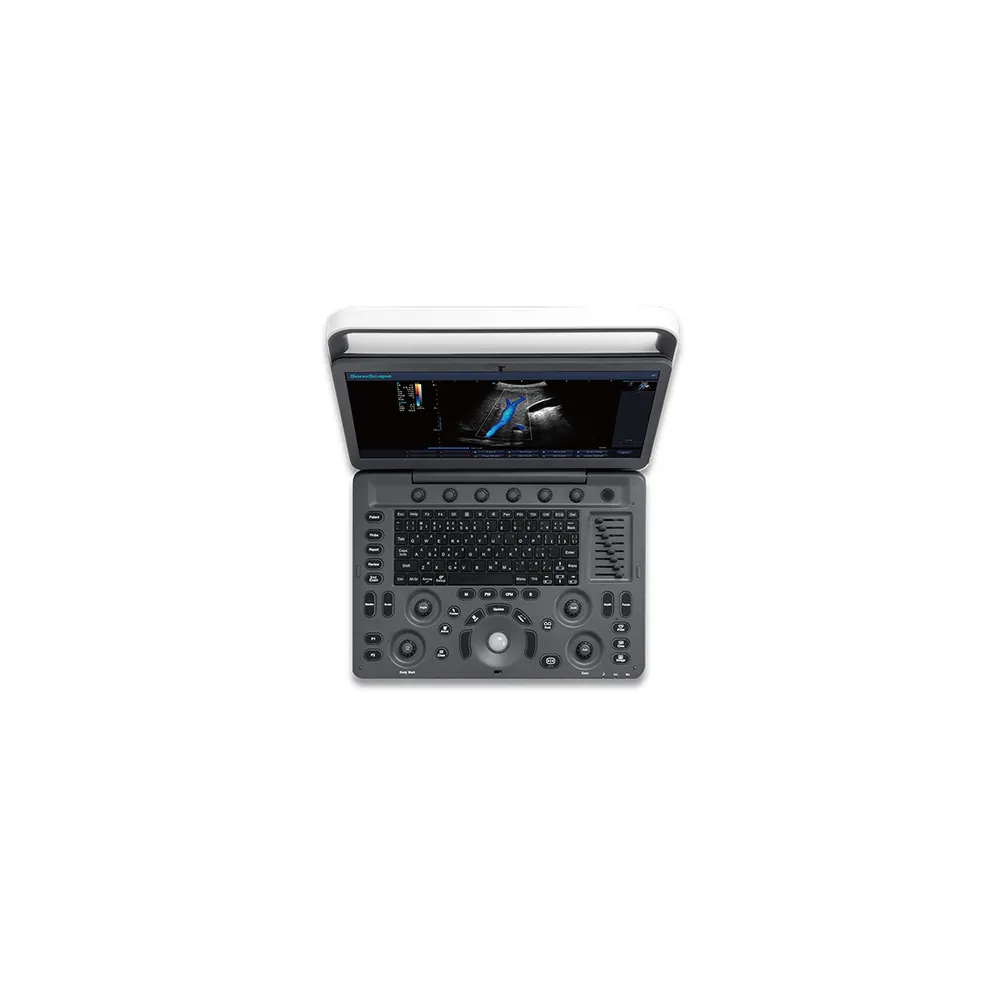 Ecograf portabil Doppler color SonoScape E2