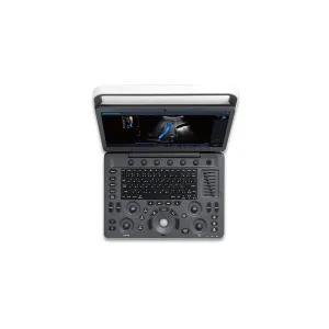 Ecograf portabil Doppler color SonoScape E2