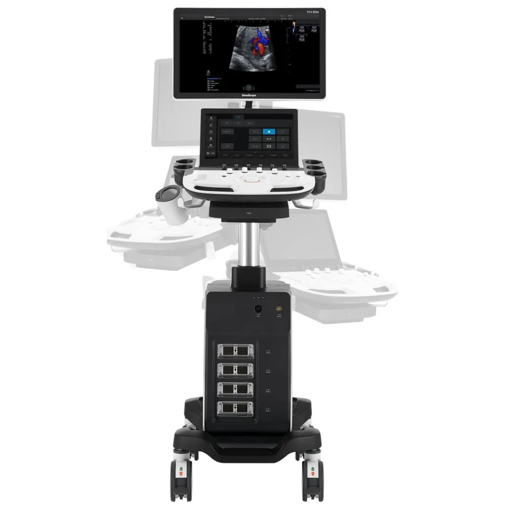 SonoScape P11 Elite – ecograf cu software GI și sondă convexă