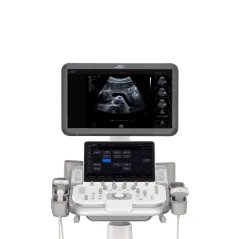 Siemens ACUSON Maple – ecograf shared services cu sonde convexă, liniară și cardiacă