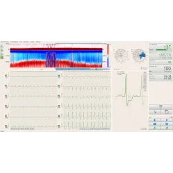 Sistem de testare la efort BTL CARDIOPOINT- ERGO E600 BTL