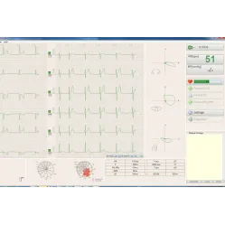 Electrocardiograf Wireless CARDIOPOINT FLEXI BTL