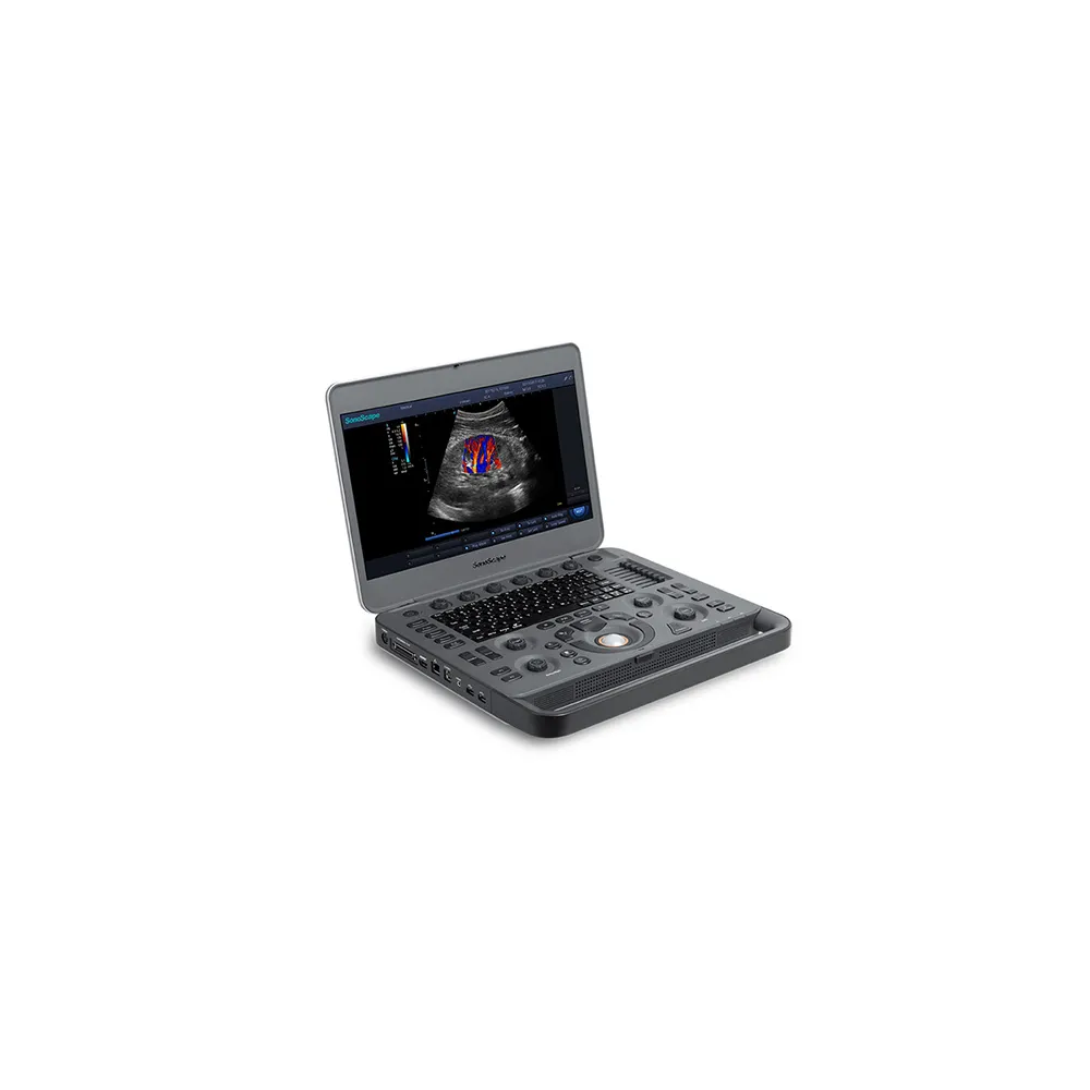 SonoScape X3 – ecograf portabil Doppler color cu sondă convexă