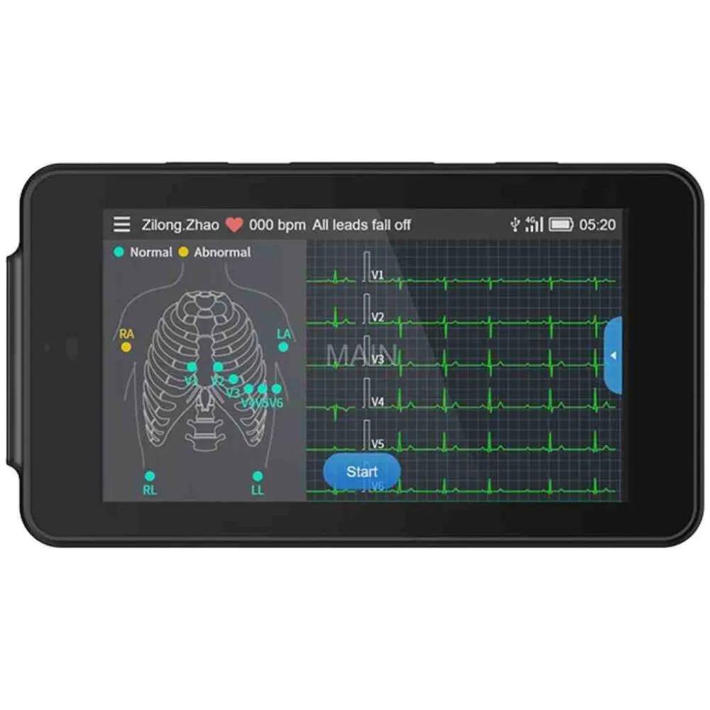 Electrocardiograf portabil LEPU PCECG-500 Pocket ECG 12 derivații
