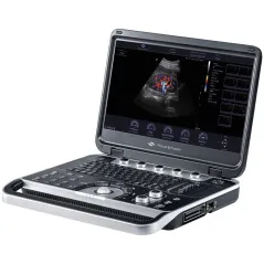 Ecograf Portabil Finus 50 Laptop – Sistem Ultrasunete Doppler pentru Radiologie și OB-GYN