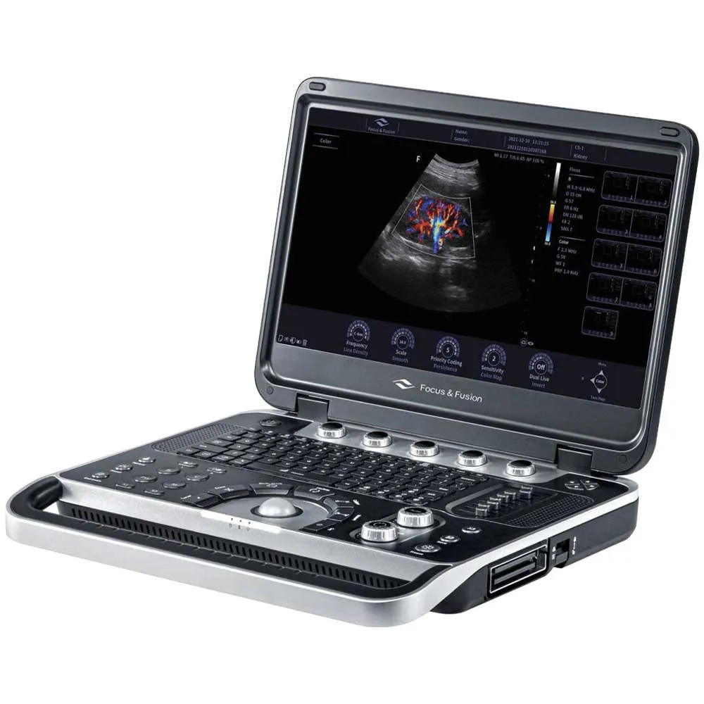 Ecograf Portabil Finus 50 Laptop – Sistem Ultrasunete Doppler pentru Radiologie și OB-GYN Ecograf Portabil Finus 50 Laptop – Sistem Ultrasunete Doppler pentru Radiologie și OB-GYN