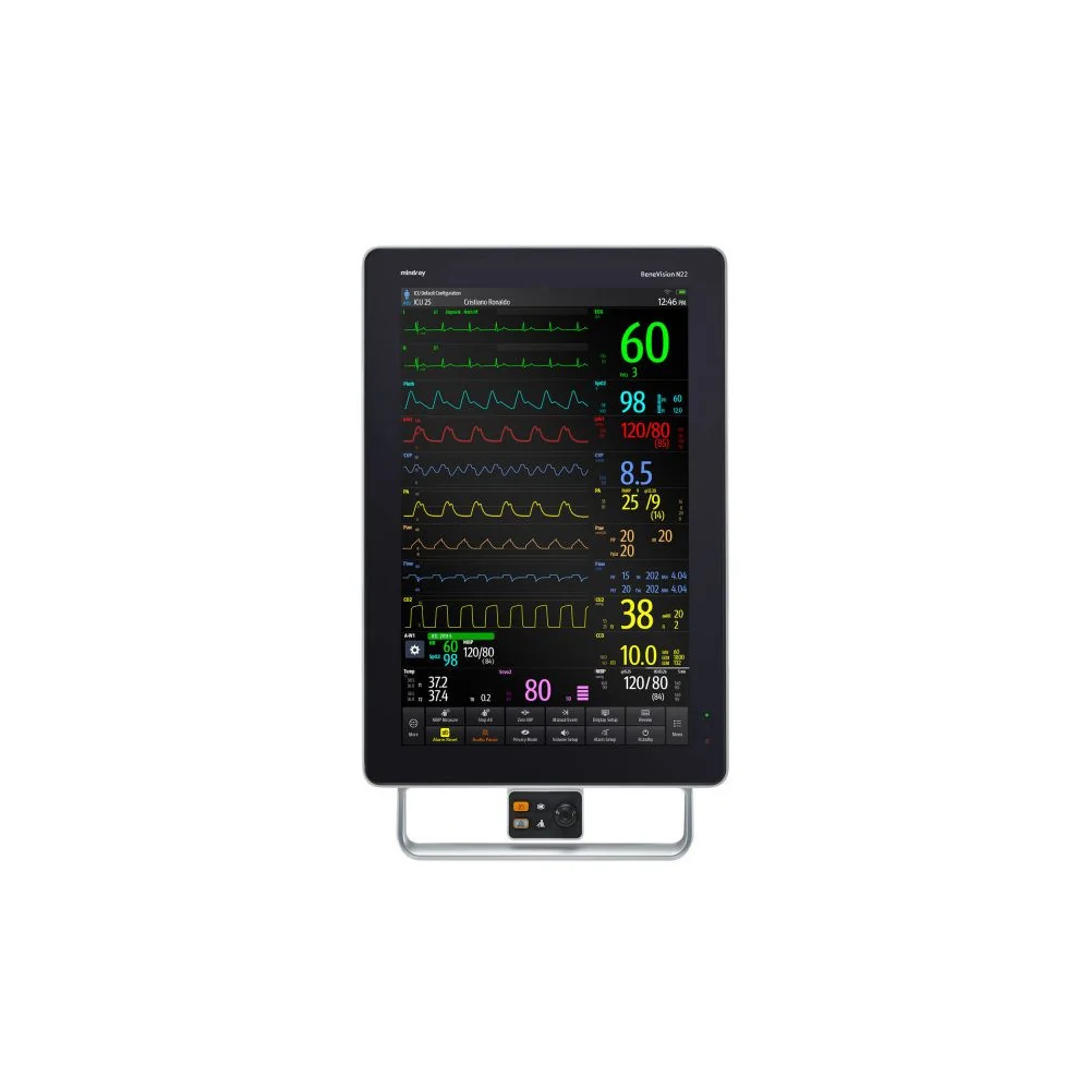 Monitor pacient Mindray BeneVision N22/N19 | ATI