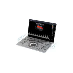 Ecograf portabil CHISON SonoAir 30 Doppler Color | POCUS
