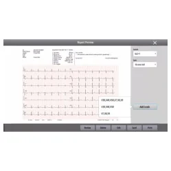 Electrocardiograf Mindray BeneHeart R700 12 canale