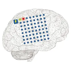 Dispozitiv stimulare electrica musculara EMS NEUROSTIMULATOR