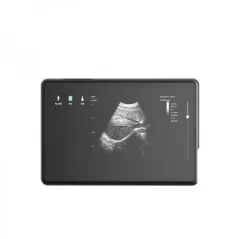 Ecograf portabil de uz veterinar EMPEROR V10 cu sonda ednorectala si convexa dedicat fertilizarilor